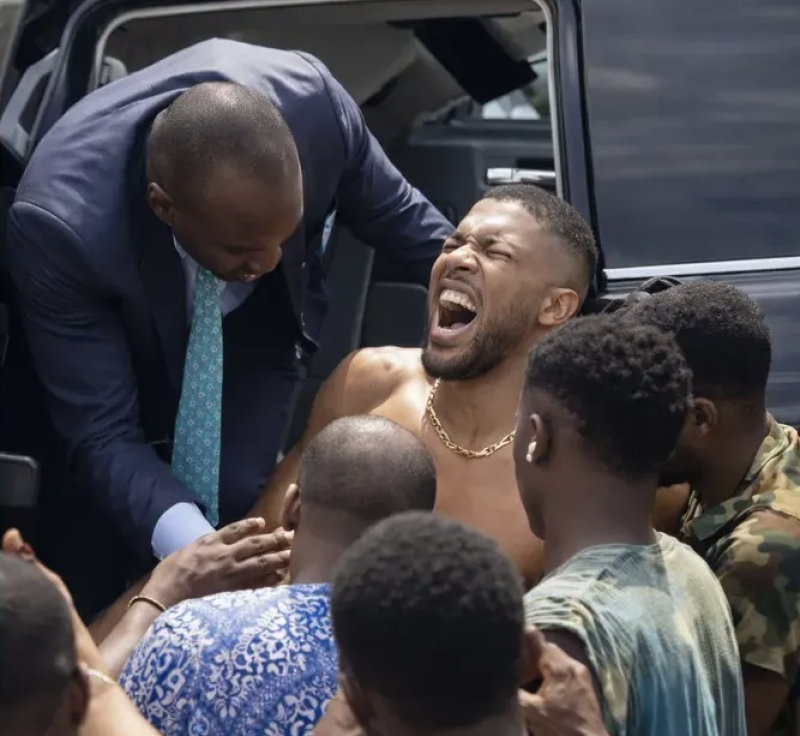 إصابة جوشوا بطل العالم السابق في الملاكمة بحادث مروع