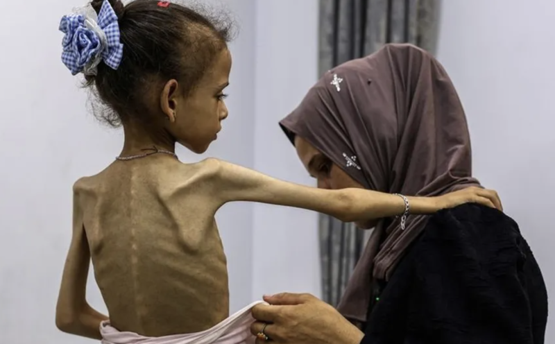 Death Toll from Famine in Gaza Rises to 332