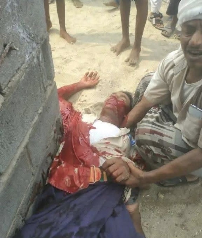 ‎‏Houthi Gunman Kills Unarmed Displaced Man While Receiving Aid in Hodeidah