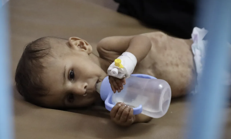 Death toll from Israel's forced starvation of Gaza reaches 367