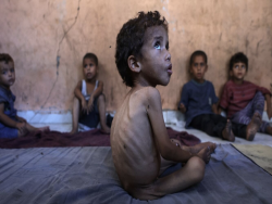 World Health Organization warns Gaza’s malnutrition rates hit alarming levels in July